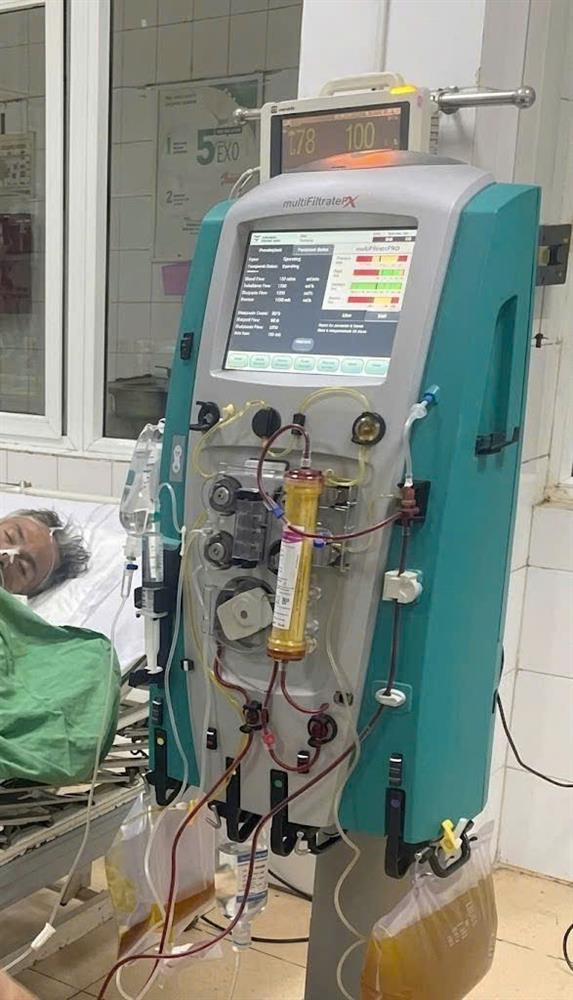 KHOA HỒI SỨC TÍCH CỰC VÀ CHỐNG ĐỘC – BVĐK HẢI DƯƠNG ỨNG DỤNG KỸ THUẬT THAY HUYẾT TƯƠNG (Plasma exchange – PEX) TRONG ĐIỀU TRỊ SUY GAN CẤP NẶNG